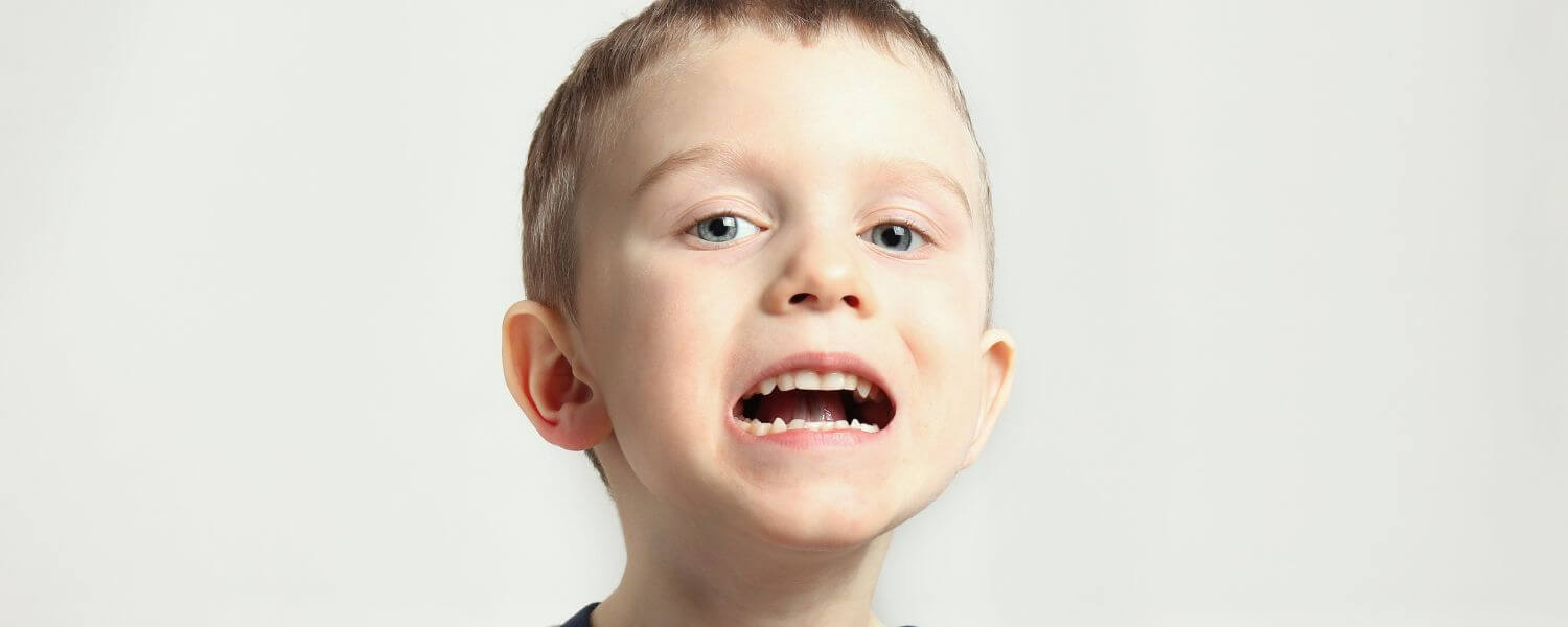 Tongue Tie (Ankyloglossia)_ Signs and Treatment Methods